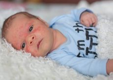 Welke vlekjes ziekten komt elke ouder tegen?