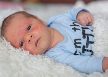 Welke vlekjes ziekten komt elke ouder tegen?